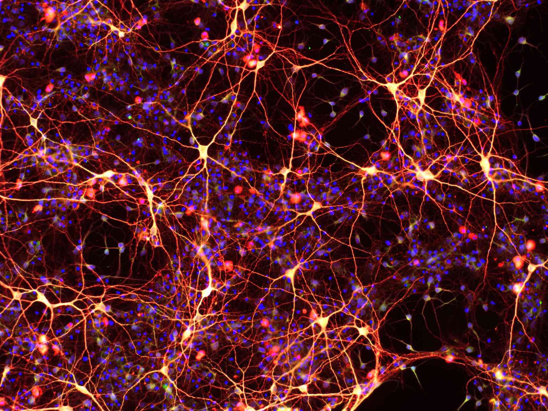 metabolic transport