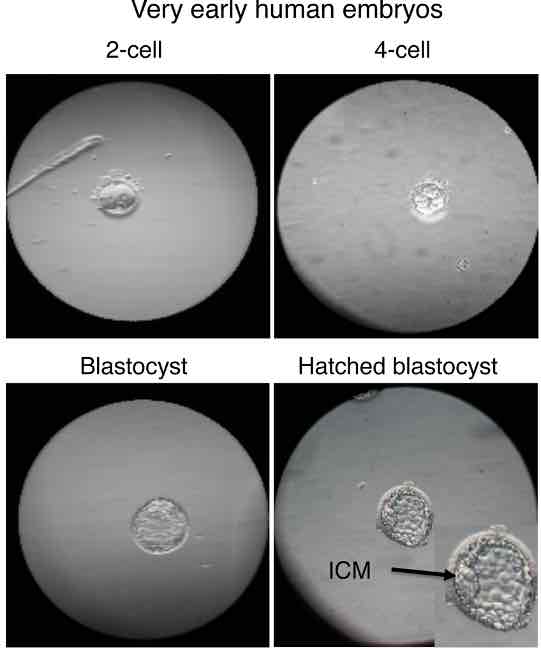 Multipotent & totipotent vs pluripotent stem cells, very early human embryos totipotent stem cells